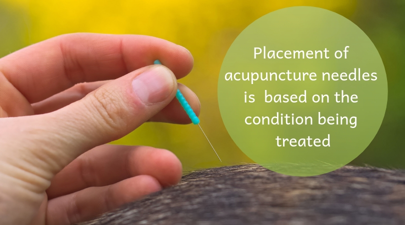 Photo of an acupuncture needle being held next to a dog