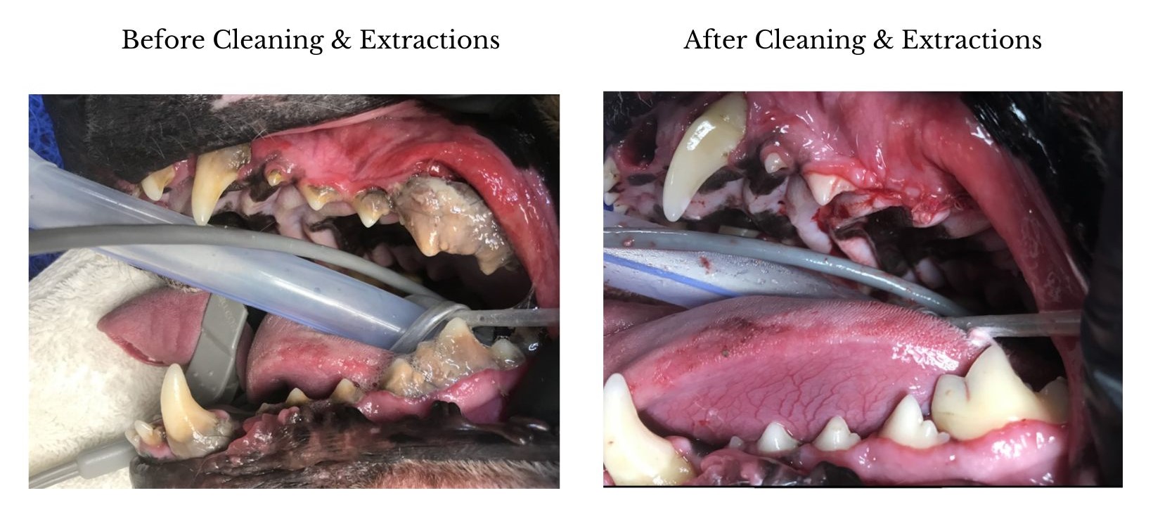 Dental before and after