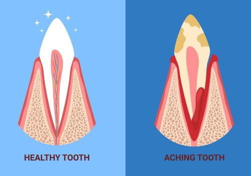 healthy dog tooth and unhealthy dog tooth