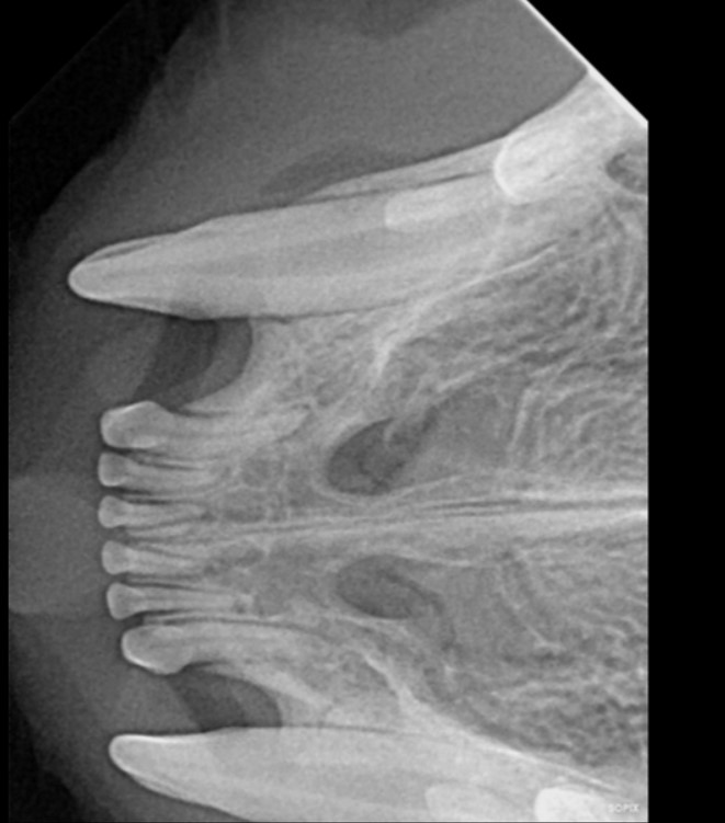 Maxillary radiograph