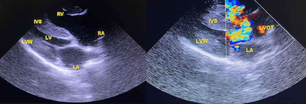 Ultrasound of canine heart, mosiac view and ventricles.